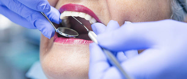 Best Emergency Gum Treatment in Columbus, NE